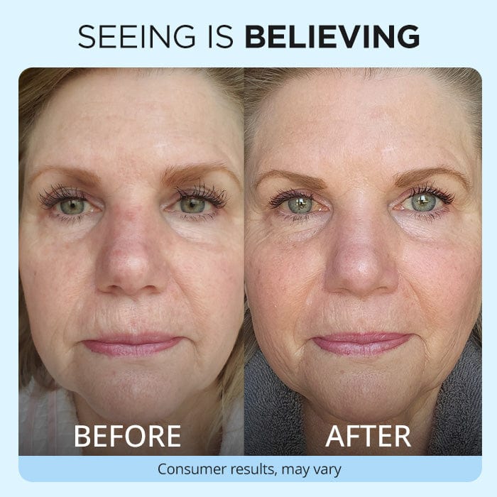 Anti Wrinkle Moisturizer - Image 3