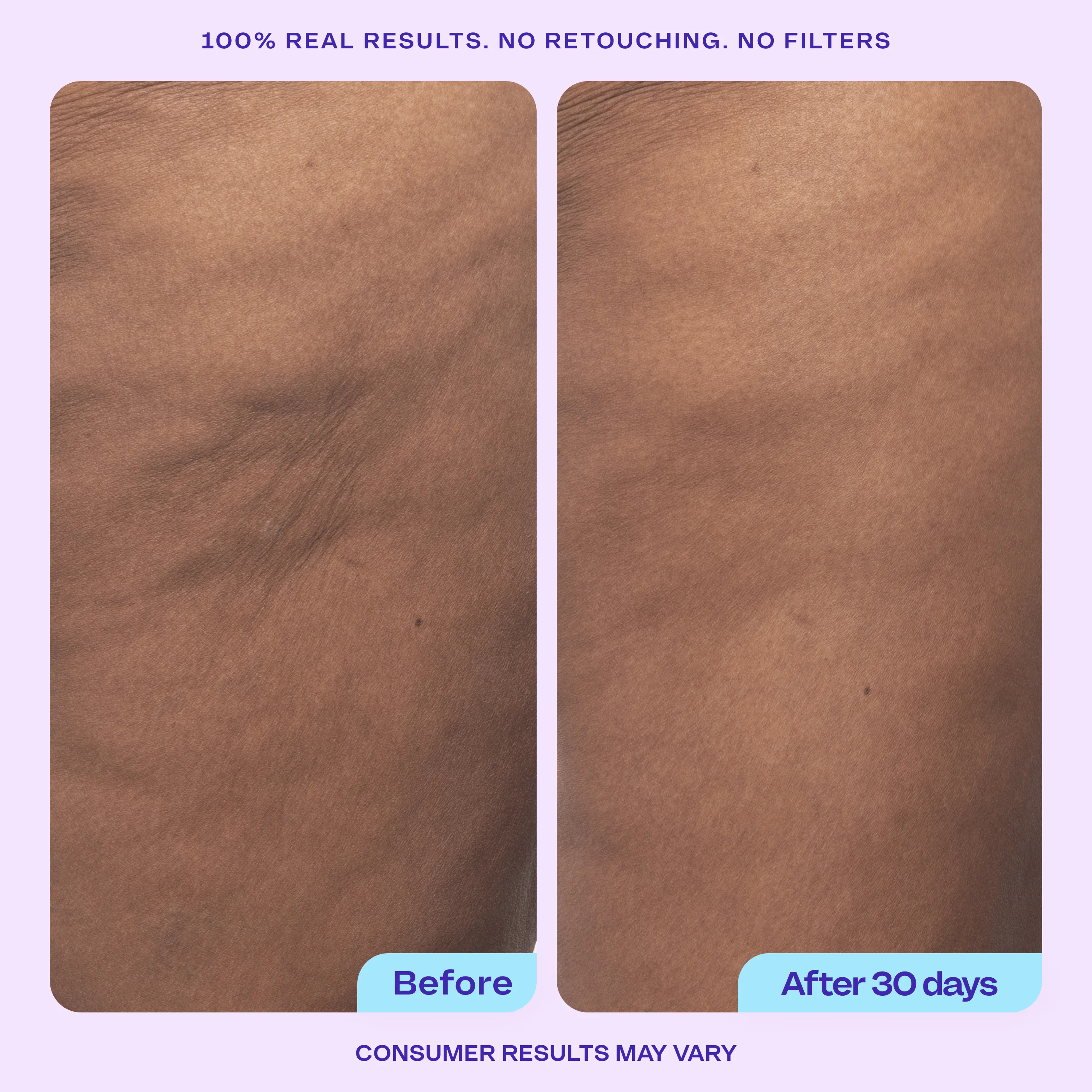 Butt & Thigh Firming Duo - Image 4
