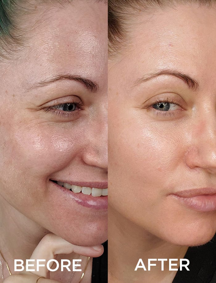 Exclusive Offer: Dramatically Dewy Serum - Image 3