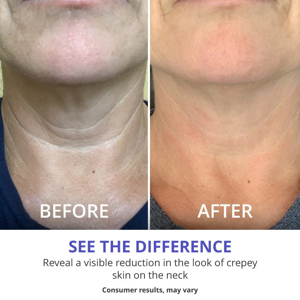 GOPURE Tighten & Lift Neck Cream - W - Image 6
