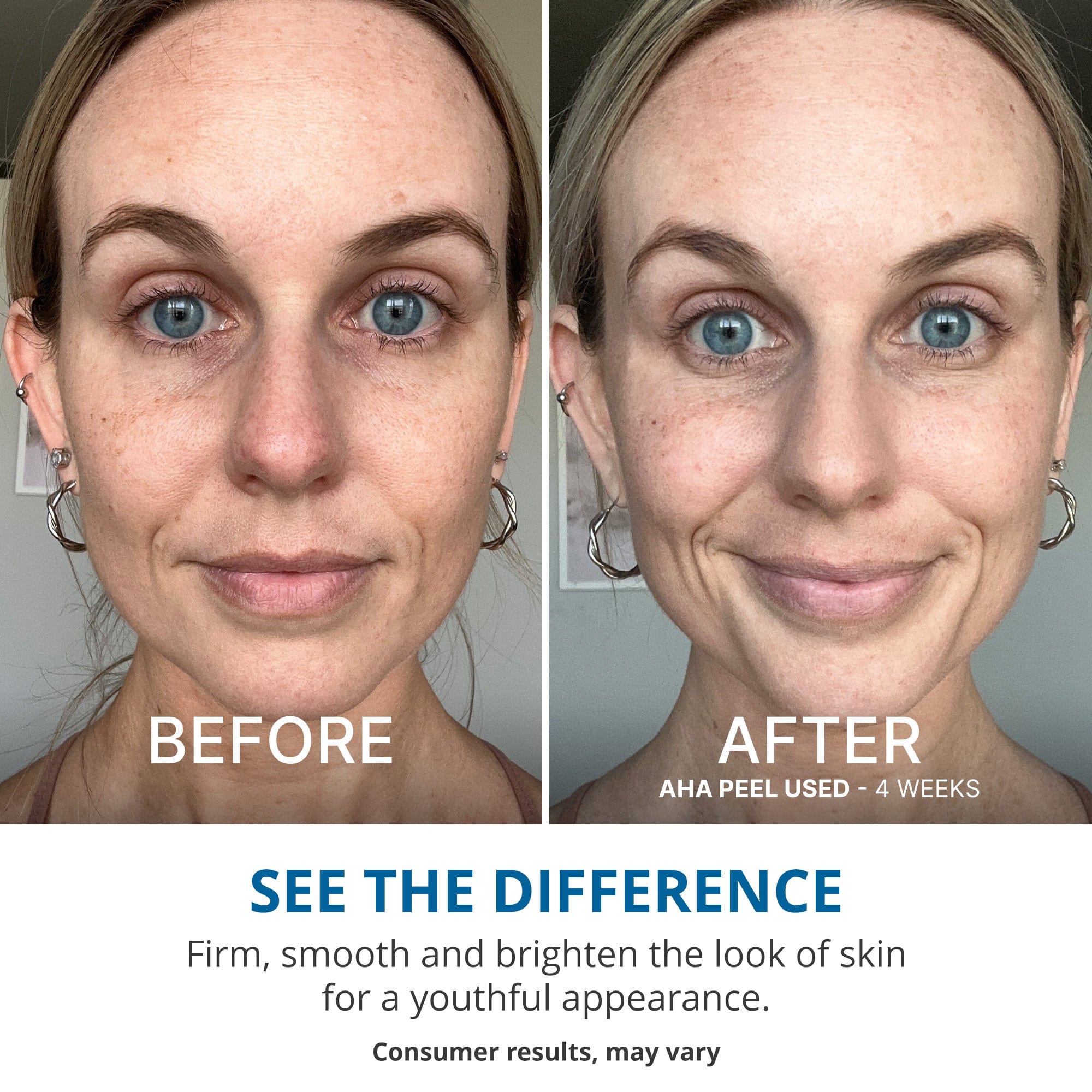 Instant Facial Exfoliation Set - Image 5