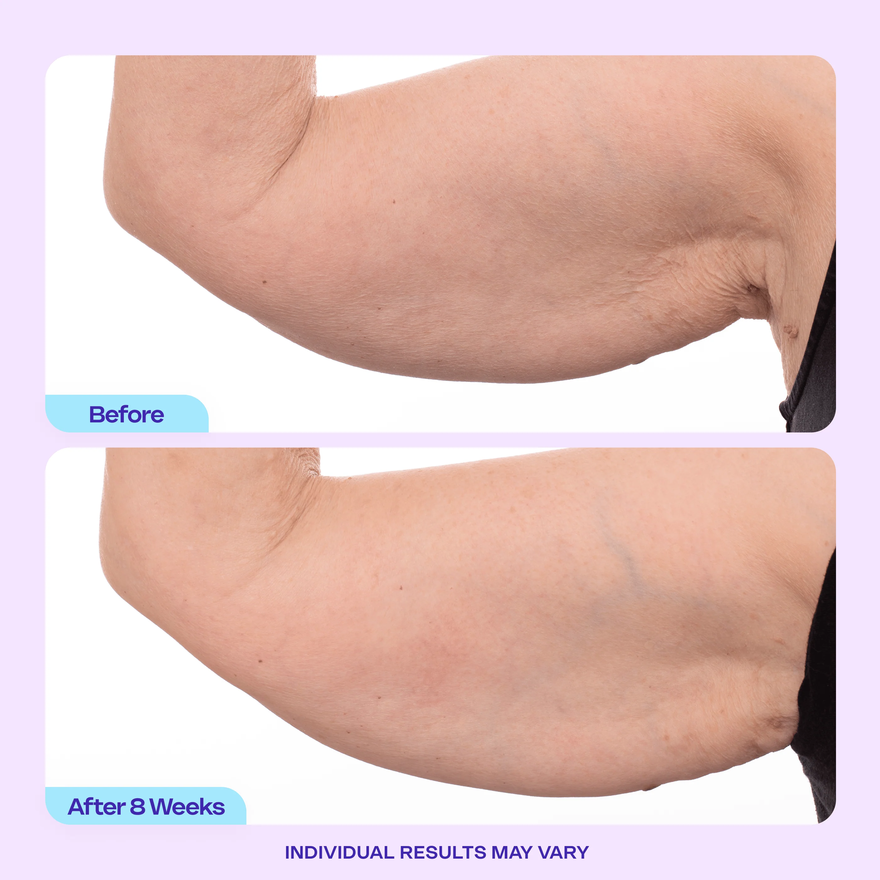 Sculpt & Tone Arm Cream - Image 6