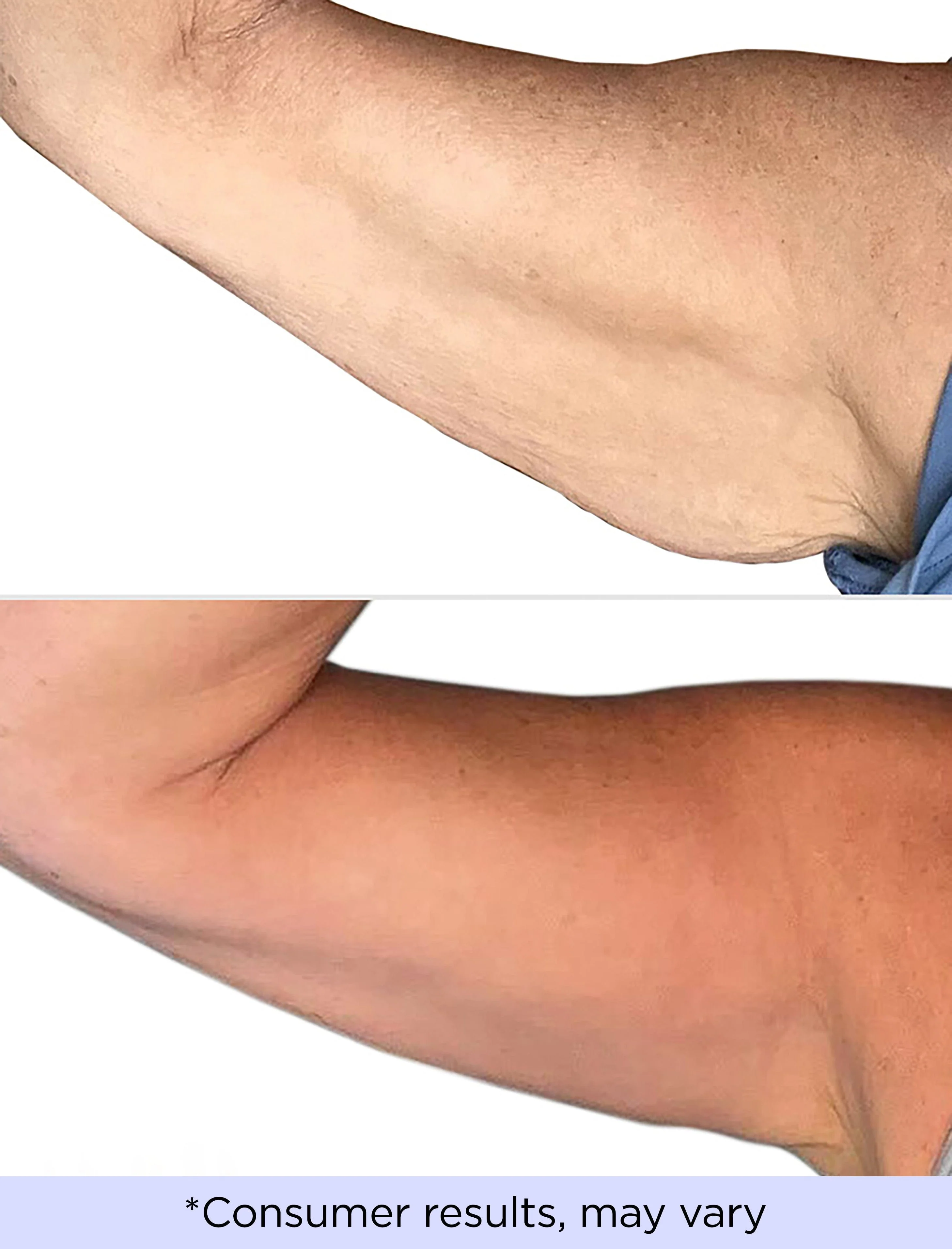 Sculpting Arm Cream + Tighten & Lift Neck Cream - Image 5