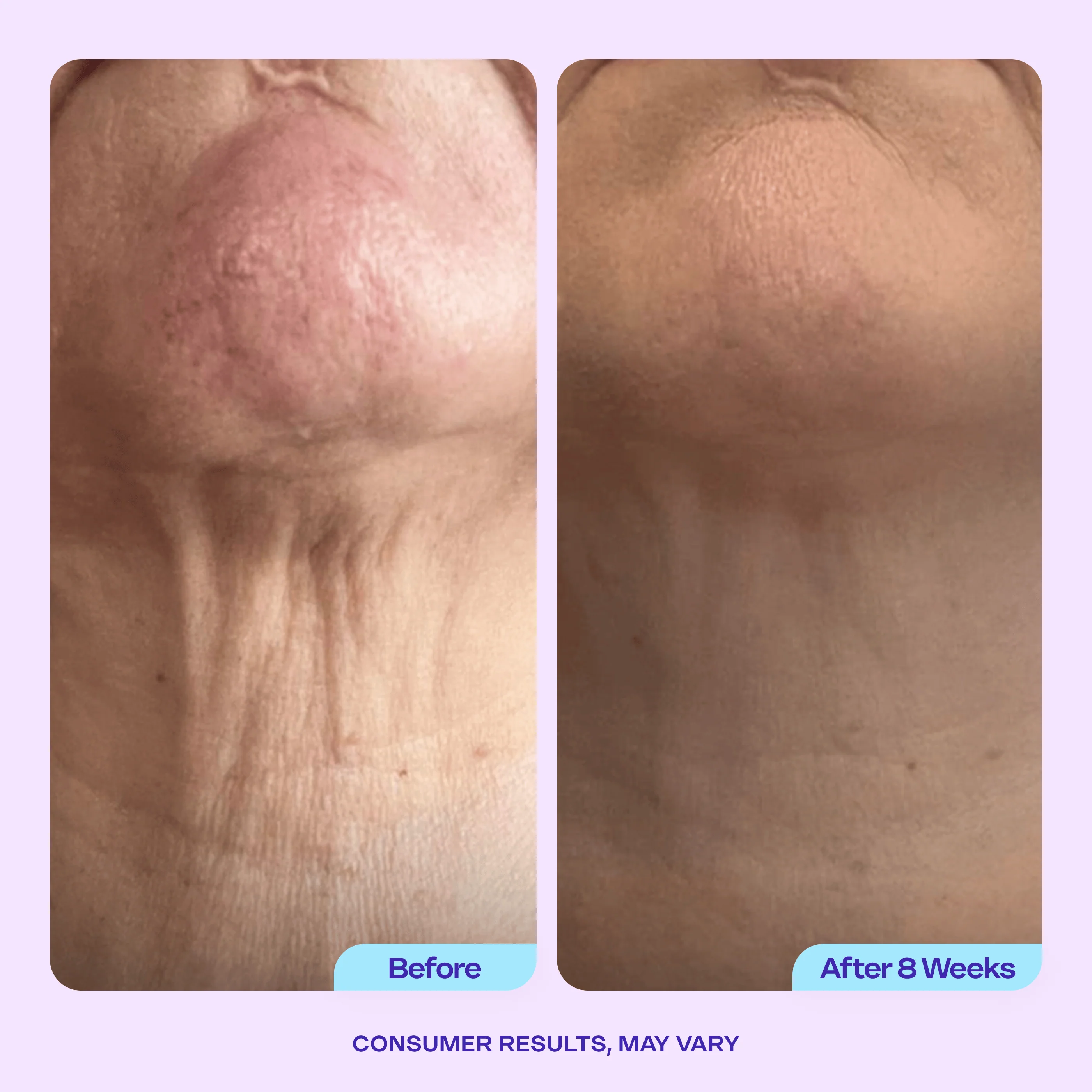Tighten & Lift Neck Cream - Image 8