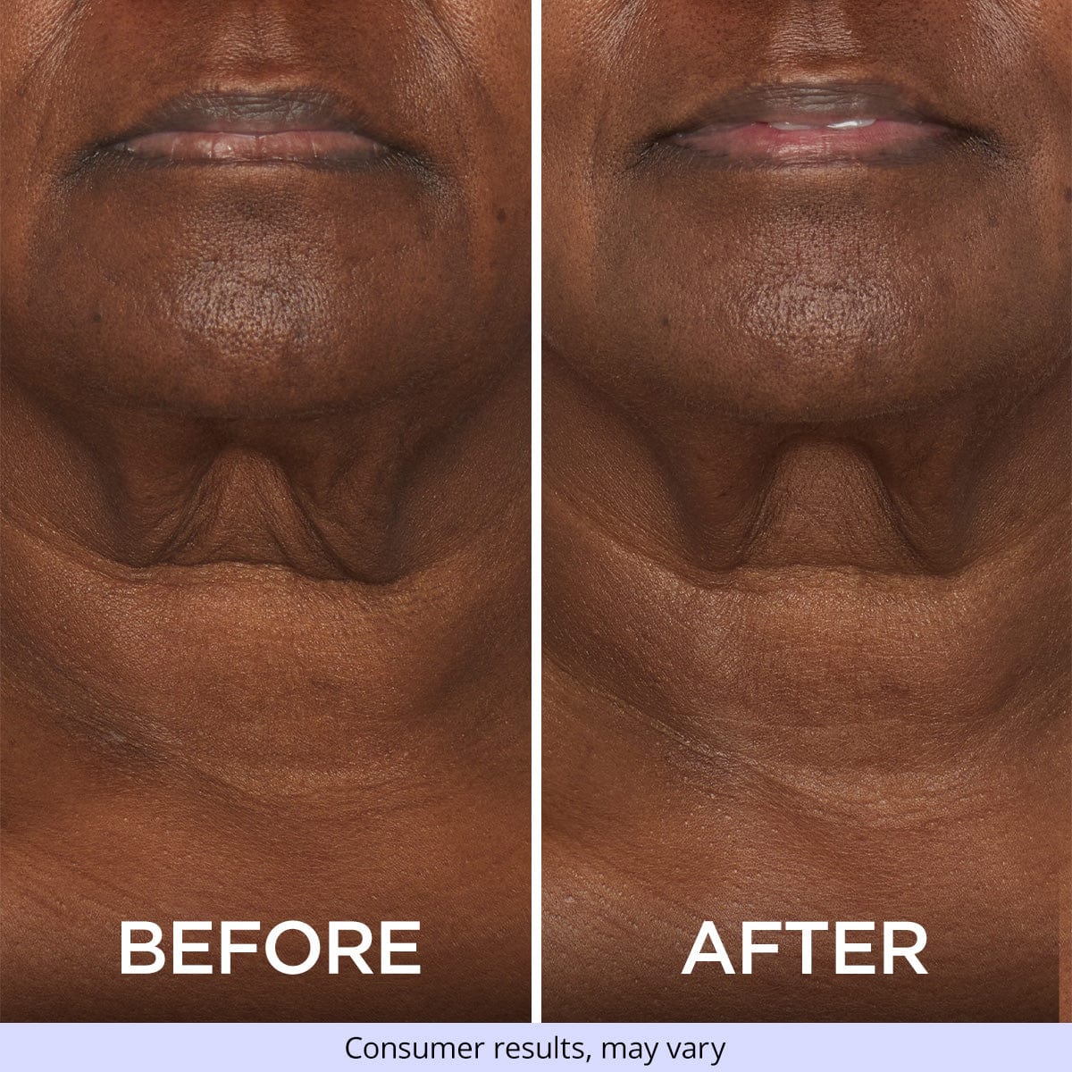 Tighten & Lift Neck Cream - Image 9